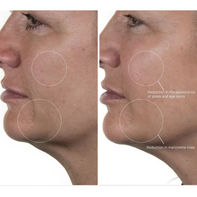 Сироватка для обличчя Augustinus Bader The Serum 7ml